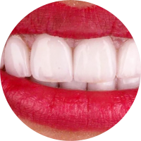 Bước 5: Kiểm tra thẩm mỹ và chức năng - điều chỉnh - chụp hình hoàn tất