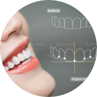 Bước 2: Nụ cười thử nghiệm