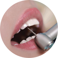 Bước 3: Sửa soạn răng